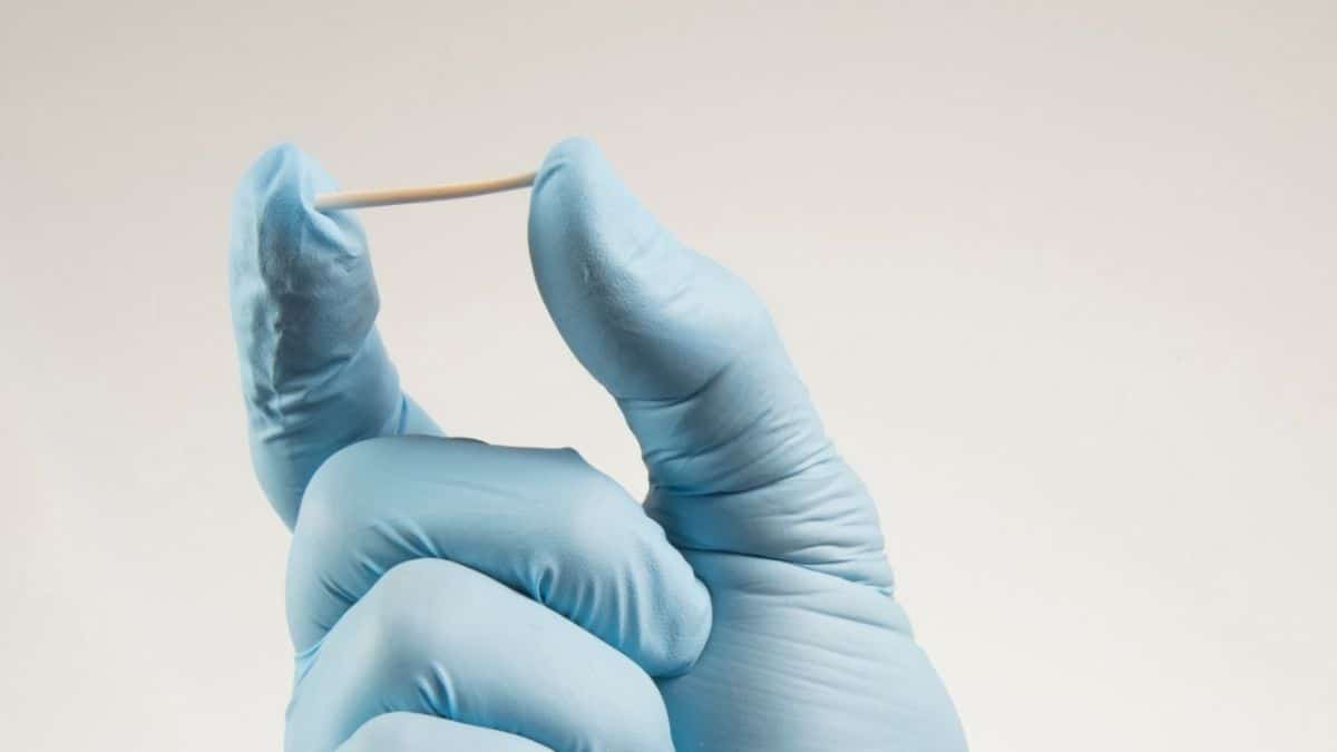 Implante contraceptivo caro chega de graça ao SUS em cidades do Paraná