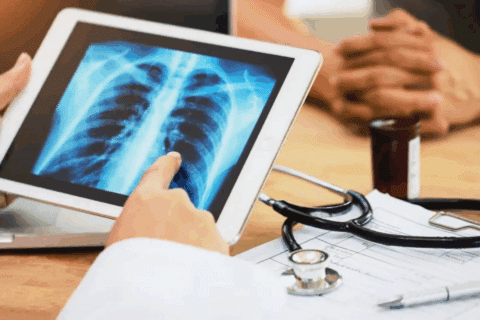 Vacina pioneira contra câncer de pulmão inicia testes em humanos em 2026