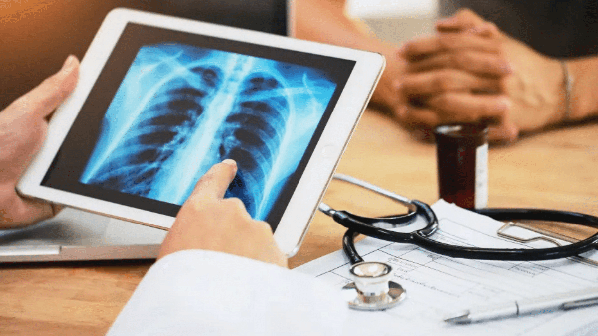 Vacina pioneira contra câncer de pulmão inicia testes em humanos em 2026