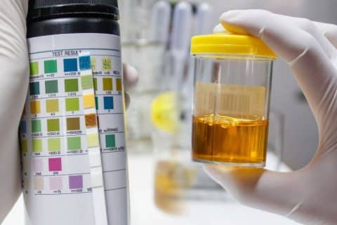Como a Cor do Xixi Indica o Nível de Hidratação do nosso corpo