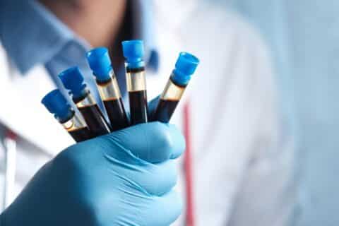 Exame de sangue pode antecipar tratamento do câncer de pulmão