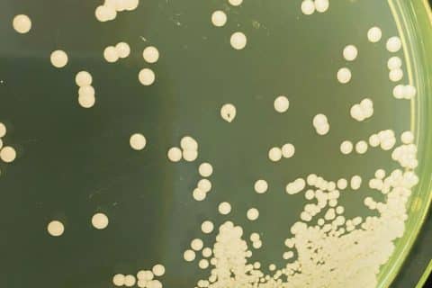Casos de Candida auris colocam saúde de Portugal em alerta