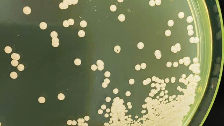 Casos de Candida auris colocam saúde de Portugal em alerta