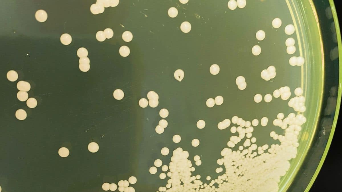 Casos de Candida auris colocam saúde de Portugal em alerta